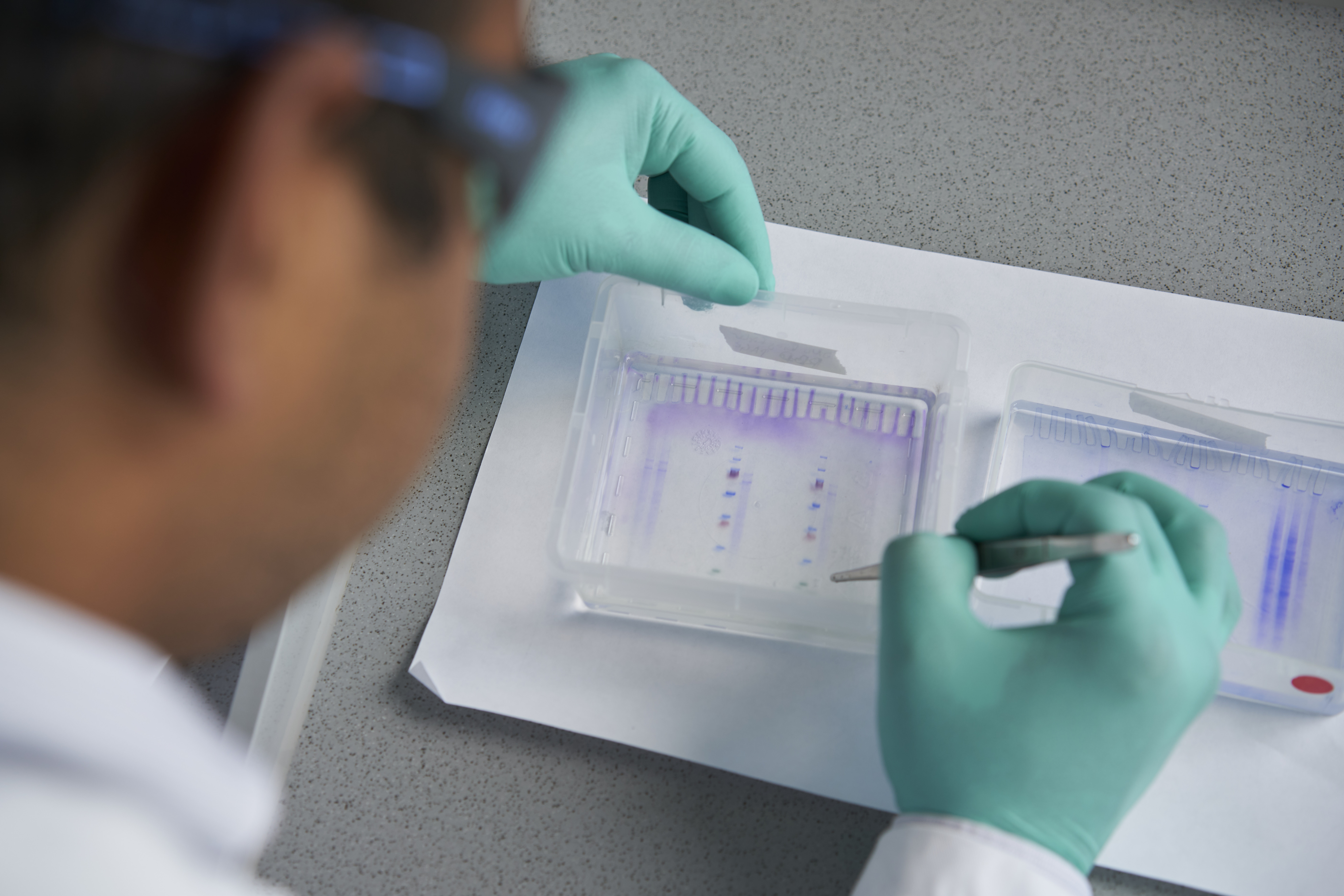 Protein gel analysis