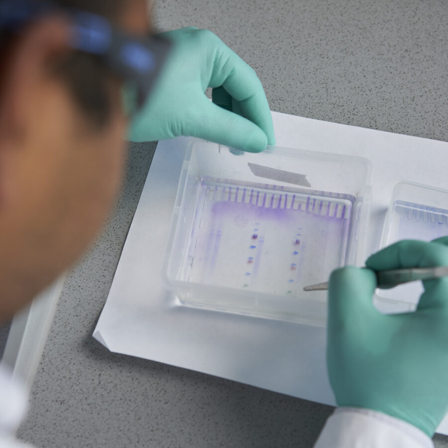 Protein-gel-analysis-aspect-ratio-900-900